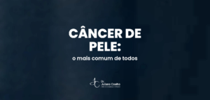 Card do artigo: cancer de pele nao melanoma